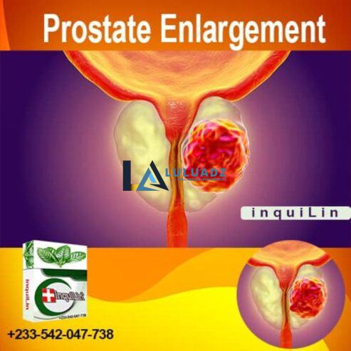 Enlarged Prostate Medicine